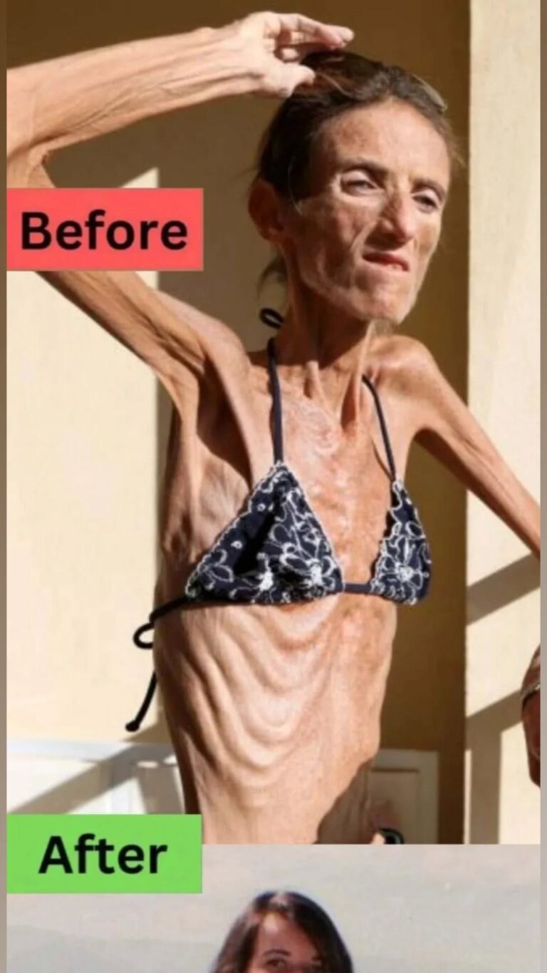🥰THE WORLD’S THINNEST WOMAN’S