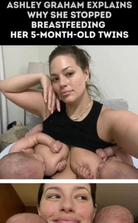 A Woman Shows The Postpartum Bodies