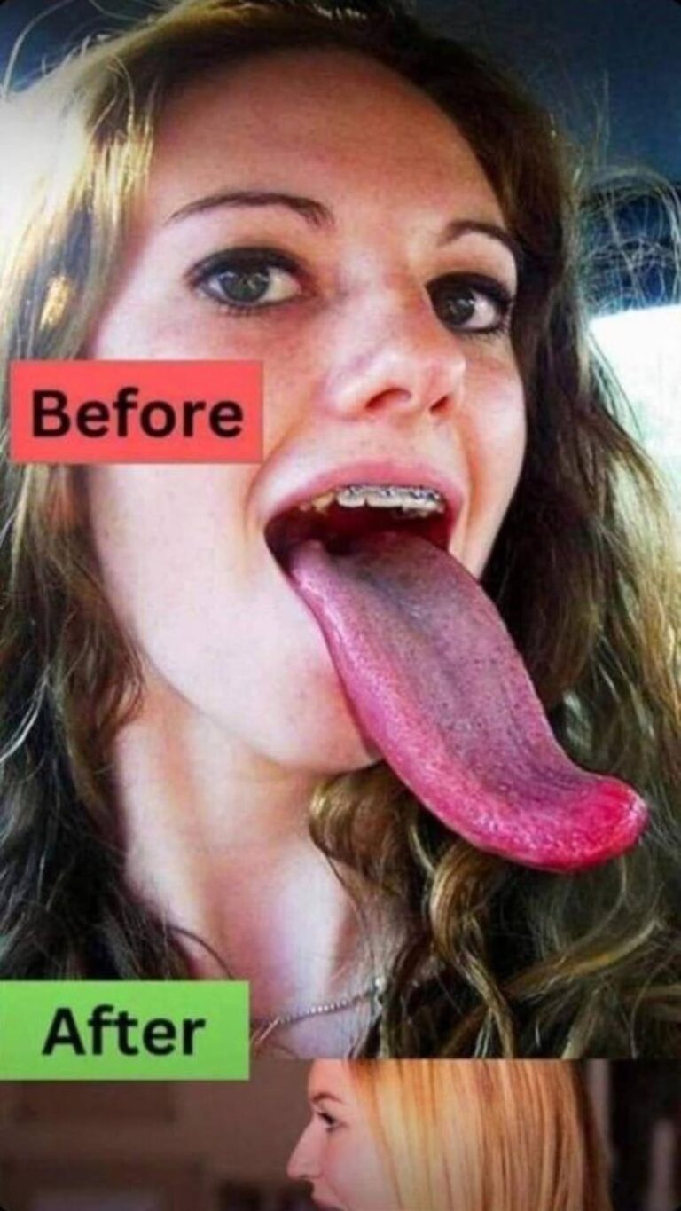 What White Tongue Is, and What to Do About It