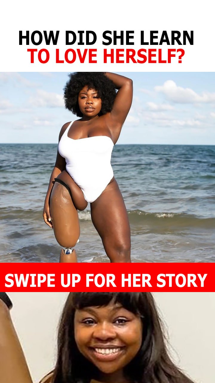 The Bionic Model Who Defied Limits-How She Learned to Love Her Body and Break Society’s Stereotypes